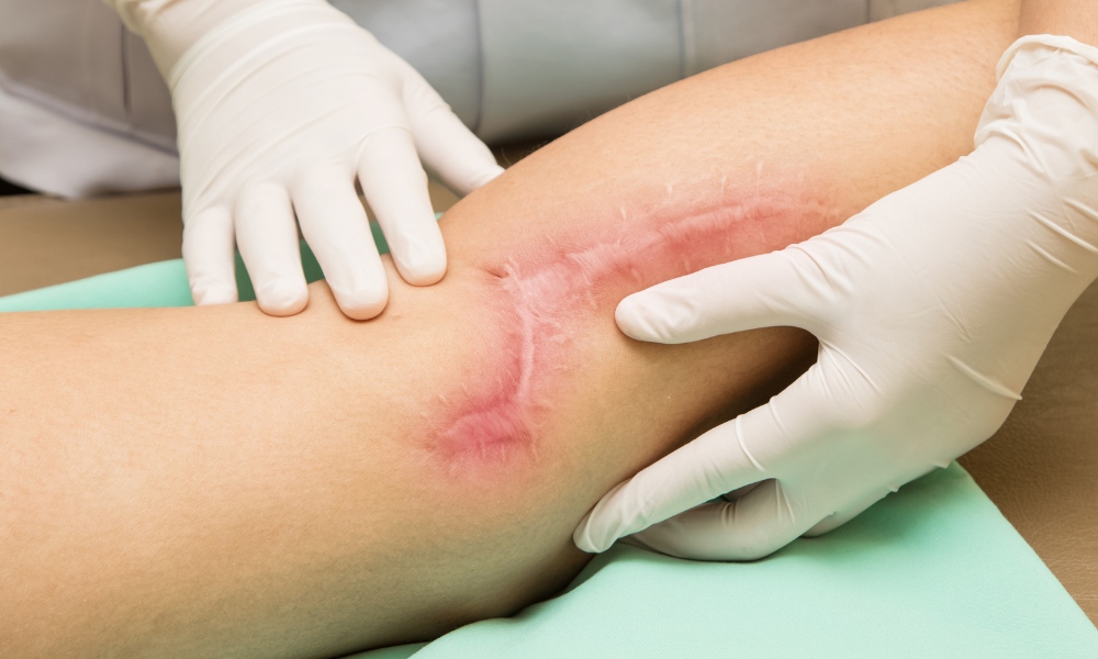 The Internal and Structural Science of Scar Rehabilitation
